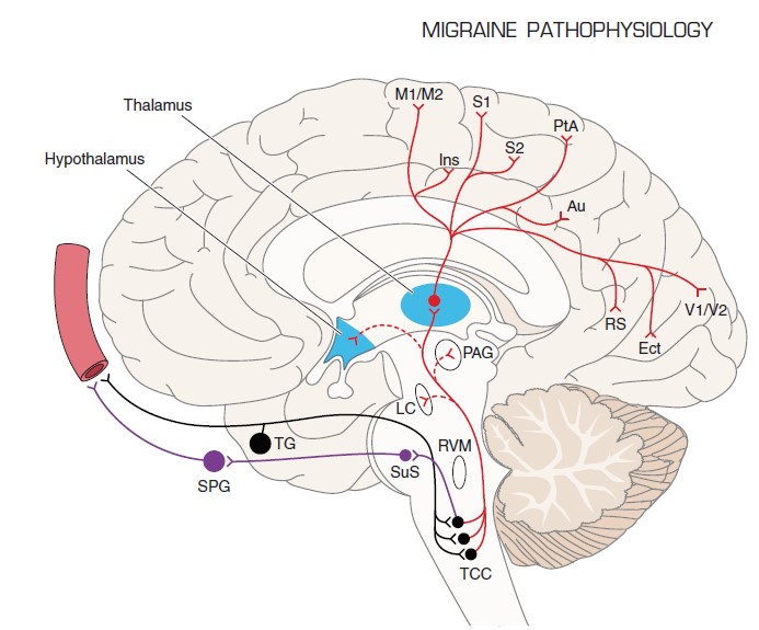 Migraine Pathophysiology